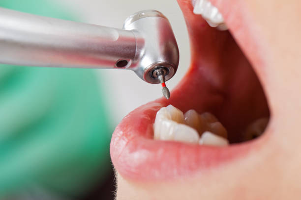 Best Emergency Tooth Extraction in Garden City Park, NY